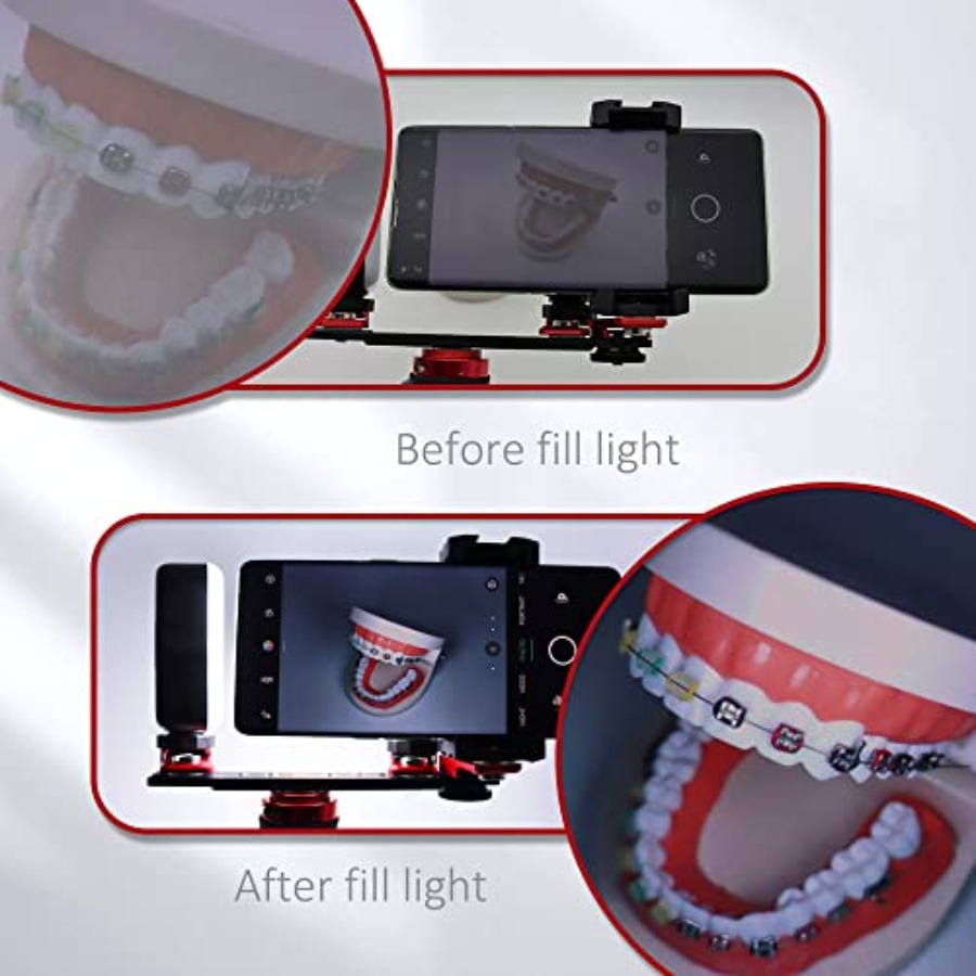 Bluetooth Dental Flash Light P - Photography Lighting Led ulasan dan harga