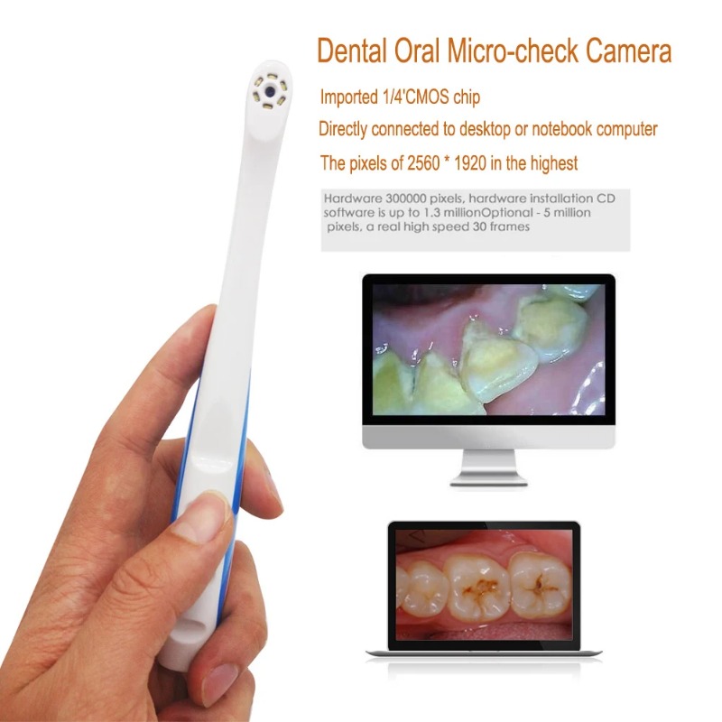USB Dental Camera Wireless Int - Photography Lighting Patterns ulasan dan harga